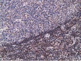 PDLIM2 / SLIM Antibody (clone OTI11A12)