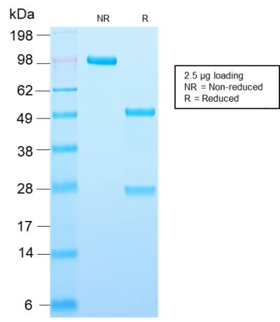 PLIN2 / ADFP / Adipophilin Antibody (aa 249-376, clone ADFP/2755R)