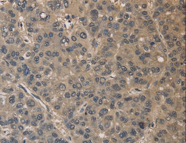 DRG1 / NEDD3 Antibody