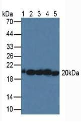 SOD2 / Mn SOD Antibody (aa25-222)