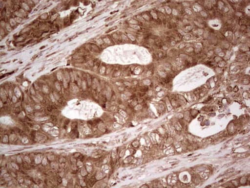MTDH / Metadherin Antibody (aa70-582, clone OTI6H2)