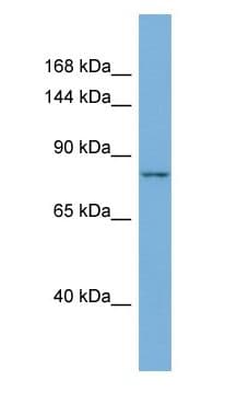 MLXIPL / CHREBP Antibody (aa142-191)