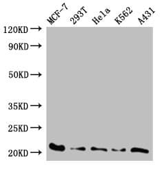 AK6 / Adenylate Kinase 6 Antibody