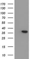 PathPlus™ ARG1 / Arginase 1 Antibody (clone 4E6)