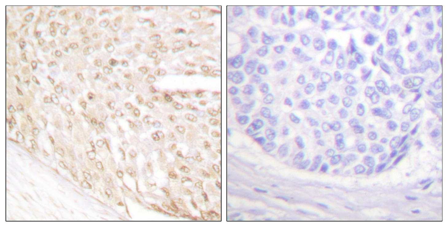 CDKN2C / p18 INK4c Antibody