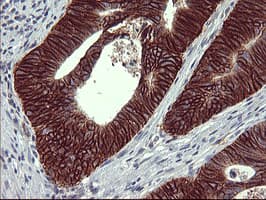 Monoclonal Mouse anti-Human CD44 Antibody (clone OTI1E3, IHC, IF, WB)