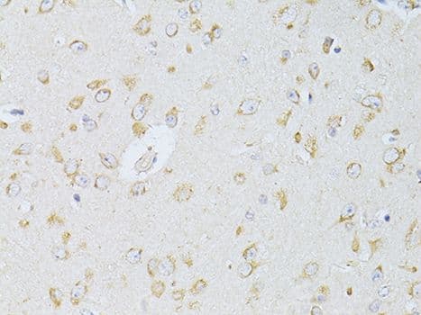 NTS / NT / Neurotensin Antibody