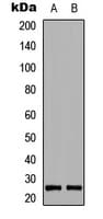 BCL2L11 / BIM Antibody (phospho-Ser69)