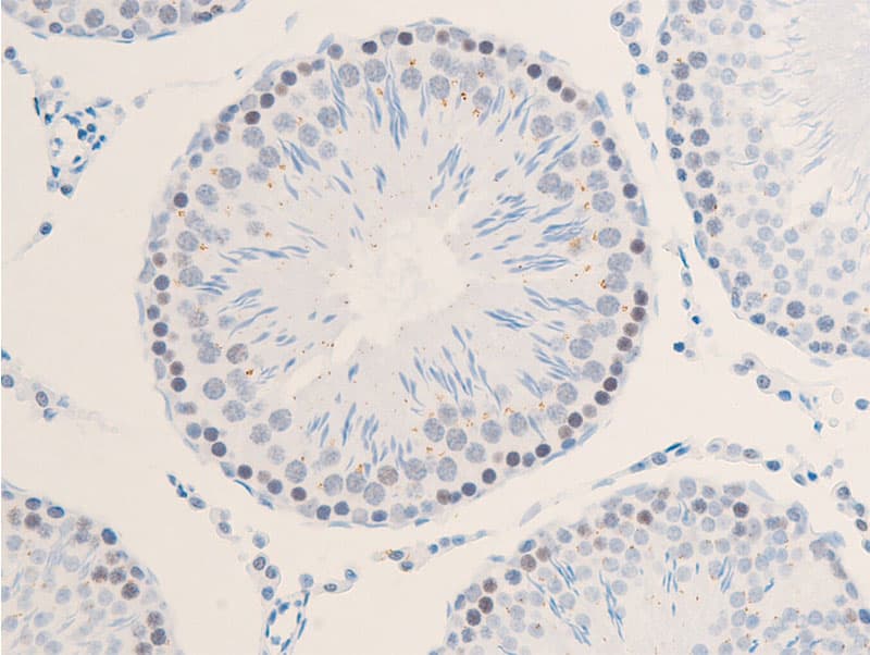 Polyclonal Rabbit anti-Human ERBB2 / HER2 Antibody (phospho-Tyr1112, IHC, IF, WB)