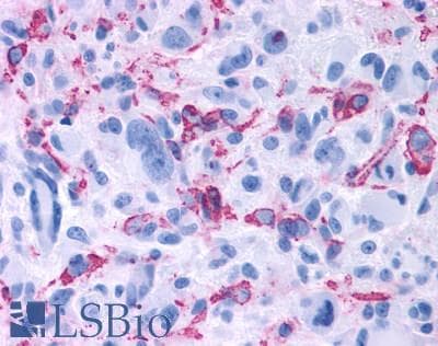 PathPlus™ GPR50 Antibody (C-Terminus)