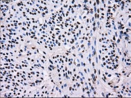 L1CAM Antibody (clone OTI2A6, Carrier-free)