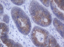 CDH1 / E Cadherin Antibody (clone OTI1F3)