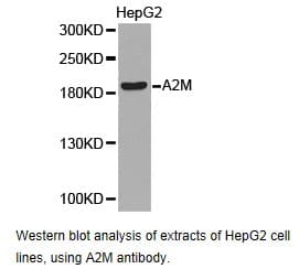 Polyclonal Rabbit anti-Human A2M / Alpha-2-Macroglobulin Antibody (IHC, WB)