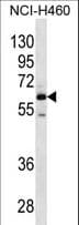 MEPE Antibody (aa19-48)