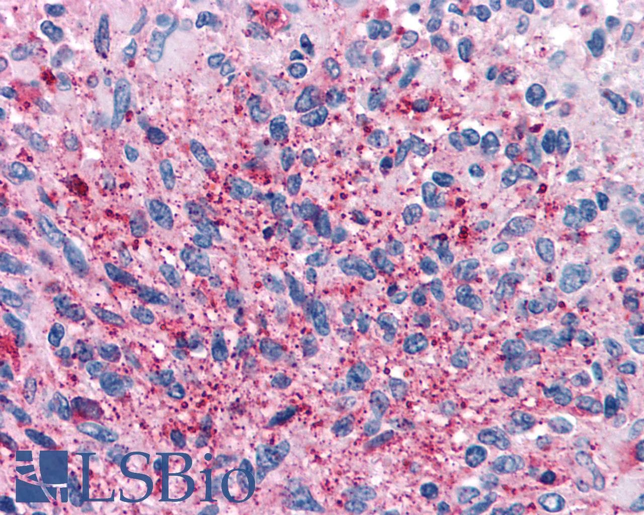 IHC-plus™ CNR2 / CB2 Antibody (Cytoplasmic Domain)