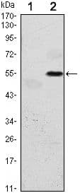 EIF2AK3 / PERK Antibody (clone 5G5)
