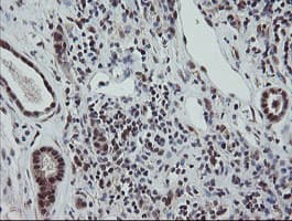 ESRRG / ERR Gamma Antibody (aa24-263, clone OTI1E5)