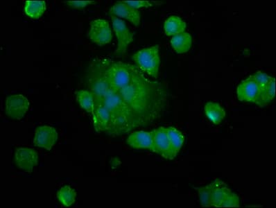 Polyclonal Rabbit anti-Human SAT2 Antibody (IHC, IF)