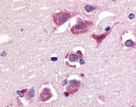 TNFSF10 / TRAIL Antibody (aa261-277)