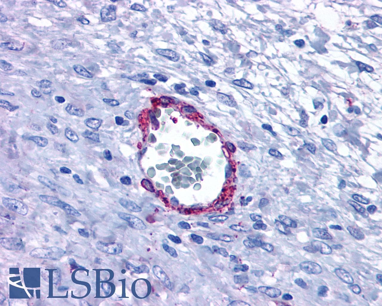 PathPlus™ Polyclonal Rabbit anti-Human HRH1 / Histamine H1 Receptor Antibody (Extracellular Domain, IHC)