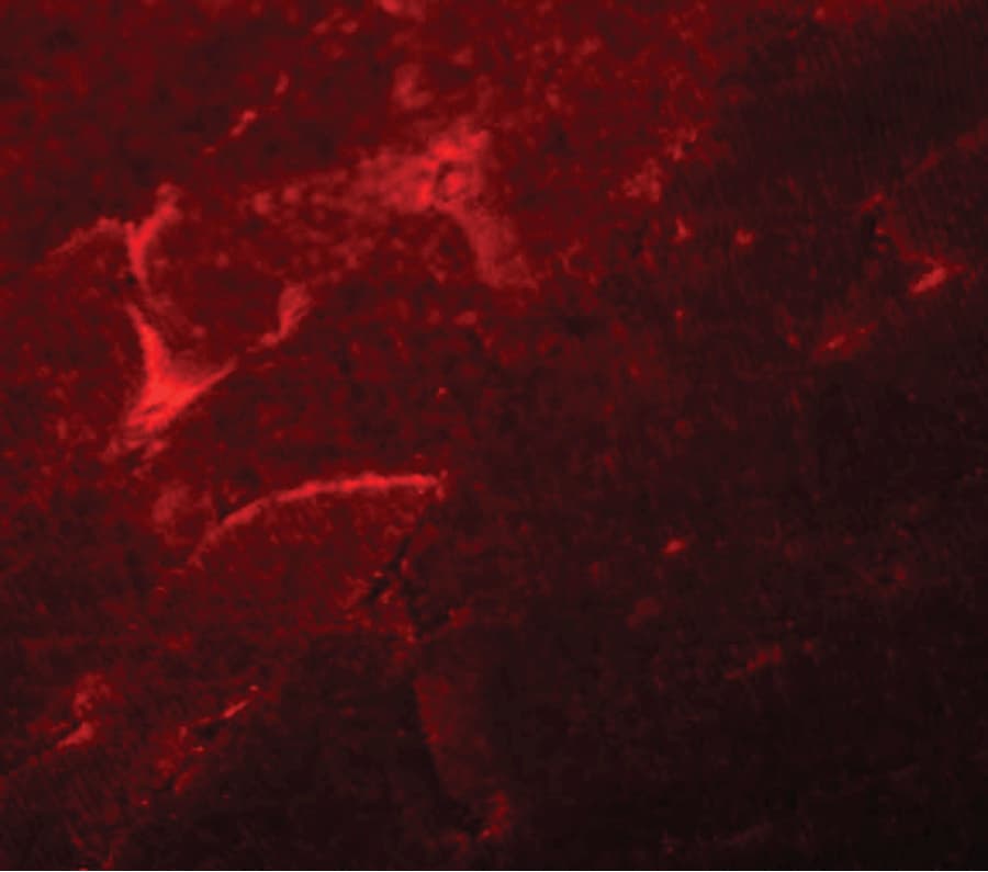 ADAMTSL5 Antibody