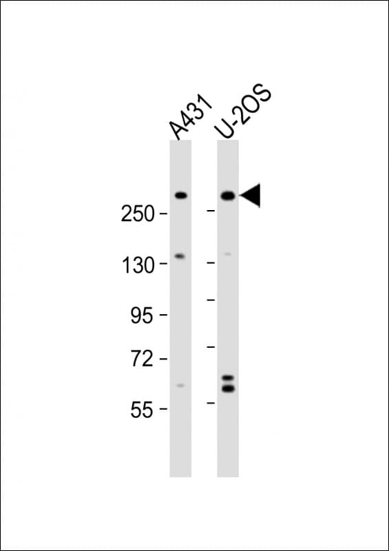 Polyclonal Rabbit anti-Human NBAS / NAG Antibody (aa628-661, WB)