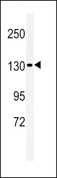 Polyclonal Rabbit anti-Human L1TD1 Antibody (aa817-848, IHC, WB)