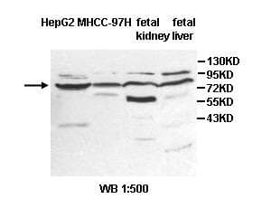 ZNF182 / ZNF21 Antibody (aa198-477)