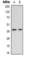 Polyclonal Rabbit anti-Human DNAM-1 / CD226 Antibody (C-Terminus, IHC, IF, WB)