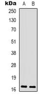 PPP1R14A / CPI-17 Antibody (N-Terminus)