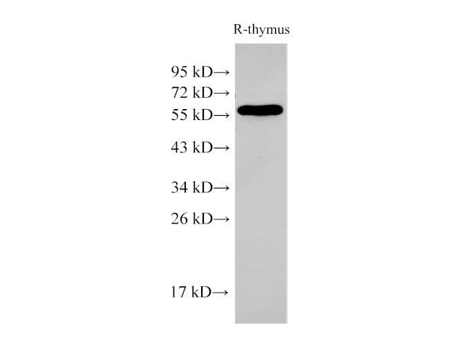 Polyclonal Rabbit anti-Human PDCD4 Antibody (IHC, WB)