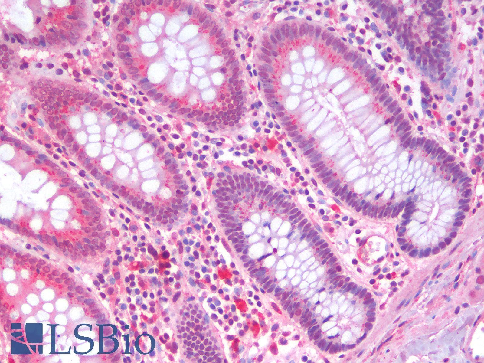IHC-plus™ Polyclonal Rabbit anti-Human SLC5A4 / SGLT3 Antibody (C-Terminus, IHC)