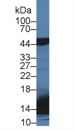 SFTPD / Surfactant Protein D Antibody (aa259-374)