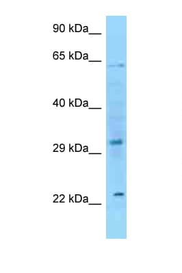 FGF8 Antibody (C-Terminus)