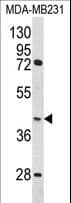 HOMER3 / Homer 3 Antibody (aa281-308)