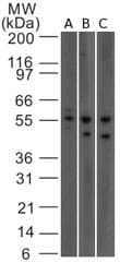 Monoclonal Mouse anti-Human IL23R Antibody (clone 15N6C6, Azide-free, aa288-315, IHC, WB)