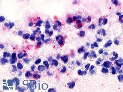 IHC-plus™ Polyclonal Rabbit anti-Human C3AR / C3a Receptor Antibody (C-Terminus, IHC)