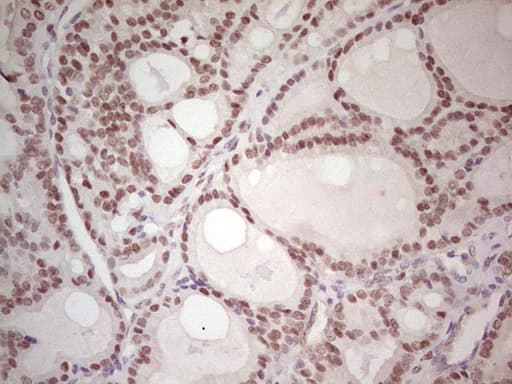 CMT2 / MAD2L1BP Antibody (clone OTI1C11, Carrier-free)