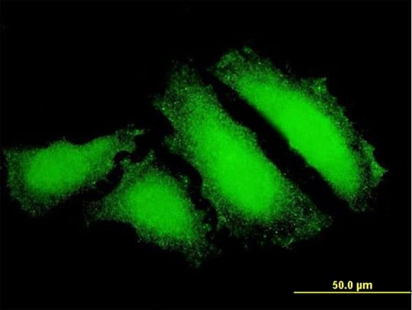 Monoclonal Mouse anti-Human FOXO3 / FOXO3A Antibody (clone 2C4, IHC, IF, WB)
