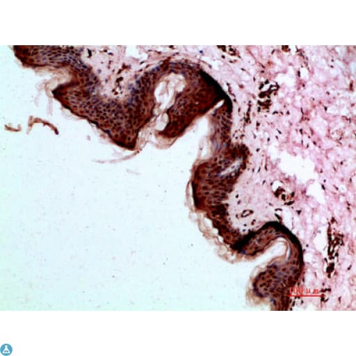 DSG1 / Desmoglein 1 Antibody