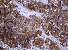 Monoclonal Mouse anti-Human TS / Thymidylate Synthase Antibody (clone 10F12, Carrier-free, IHC, WB)