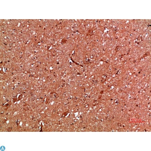 Polyclonal Rabbit anti-Human ANXA1 / Annexin A1 Antibody (IHC, WB)
