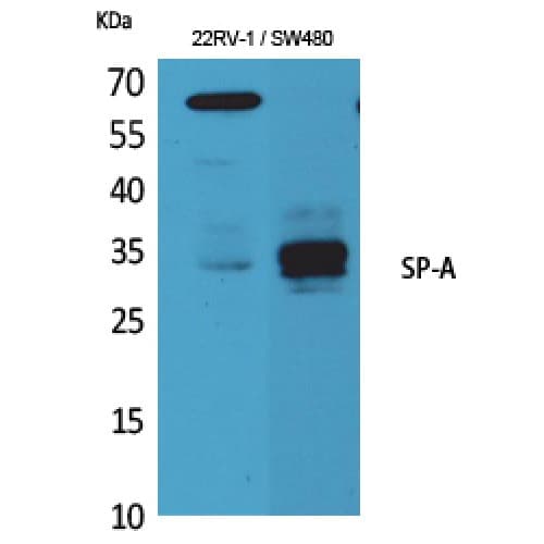 SFTPA1 / Surfactant Protein A Antibody (Internal)
