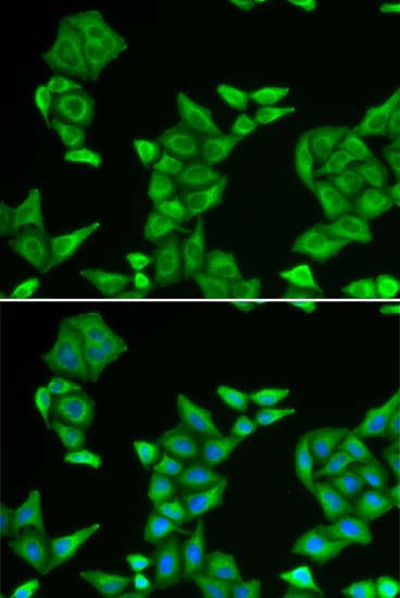 Polyclonal Rabbit anti-Human COX5A Antibody (IHC, IF, WB)