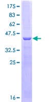 Human CES2 / Esterase Protein (Recombinant GST, N-terminus)