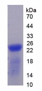 Rat THBS1 / Thrombospondin-1 Protein (Recombinant His)