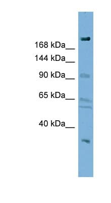 DIP2A Antibody (aa287-336)