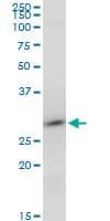 Monoclonal Mouse anti-Human RNF2 / RING2 / RING1B Antibody (clone 2B4, WB)