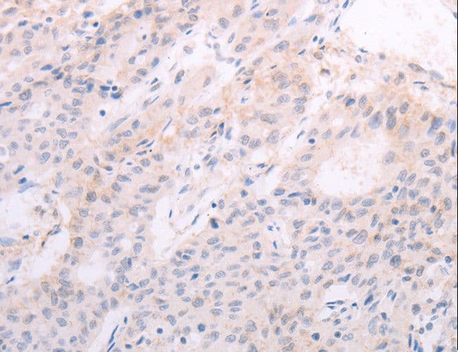 Polyclonal Rabbit anti-Human TSH Receptor / TSHR Antibody (IHC)