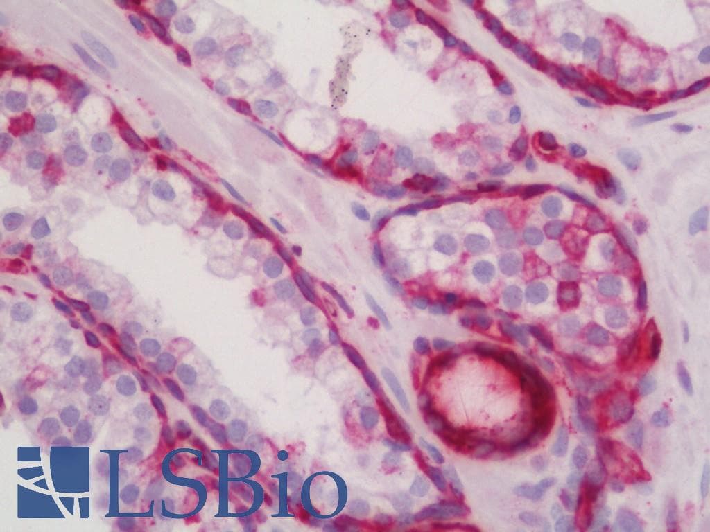 IHC-plus™ KRT19 / CK19 / Cytokeratin 19 Antibody (aa300-349)